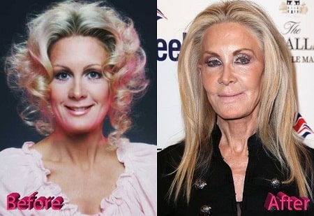 A picture of Joan Van Ark before (left) and after (right).